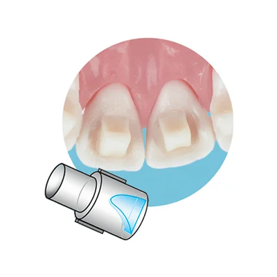 Illustration officielle SIA de la forme Mini Mold Bite-Ramp, distincte du coffret complet